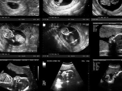 六安舒城县哪里可以做试管婴儿，六安舒城县哪里可以做试管婴儿的