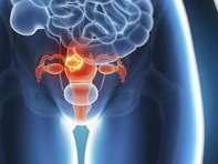 试管婴儿非降调当月移植的微刺激方案流程的利弊有哪些？